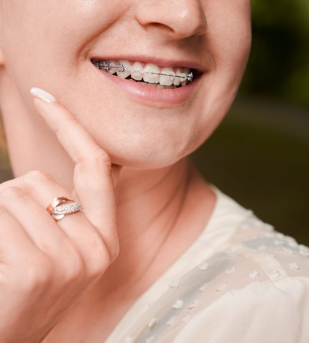 Close up of woman with orthodontic brackets on teeth touching chin and smiling. Patient demonstrating results of dental braces treatment. Concept of dentistry, stomatology and orthodontic treatment.