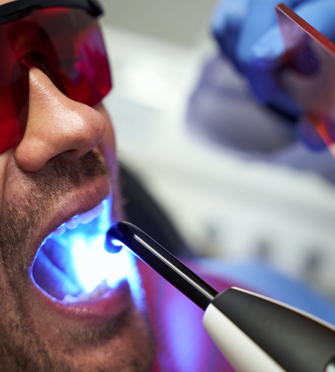 Cropped photo of man in glasses sitting in dental chair and having dental equipment in his open mouth